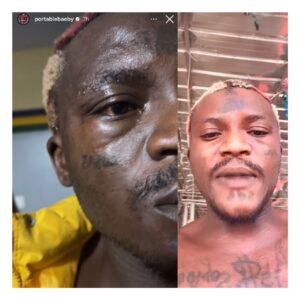 Portable attaqué par des individus