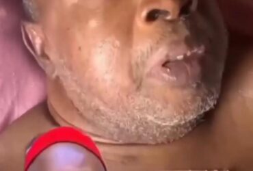 L'acteur nigérian Amaechi Muonagor mourant